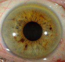 L’iridologie : un examen précieux des iris