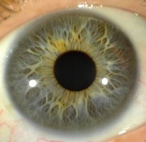 Iris plutôt vert gris avec des tons jaunes - œil d'une cliente - Naturopathie - Cabinet d' Aix en Provence