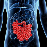 Inflammation intestinale liée à une maladie auto-immune